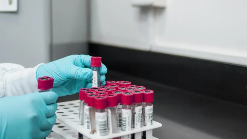 Jak uniknąć problemów z p LCR za niskie: Poradnik dla osób pracujących w laboratoriach